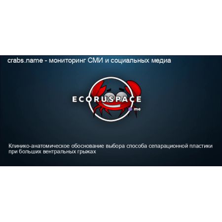 (1SAP501800R0091) DV500-EXP100 Ліцензія на розширення з 50 до 100 OPC сигналів, ABB